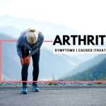 Medical Condition: Arthritis