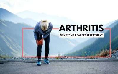 Arthritis: Symptoms, Causes, and Treatment