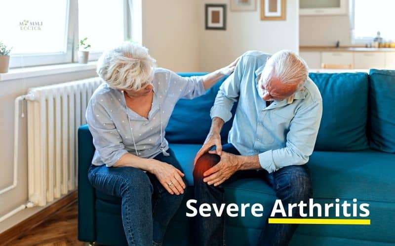Medical Condition - Severe Arthritis - Symptoms, Causes and Treatment