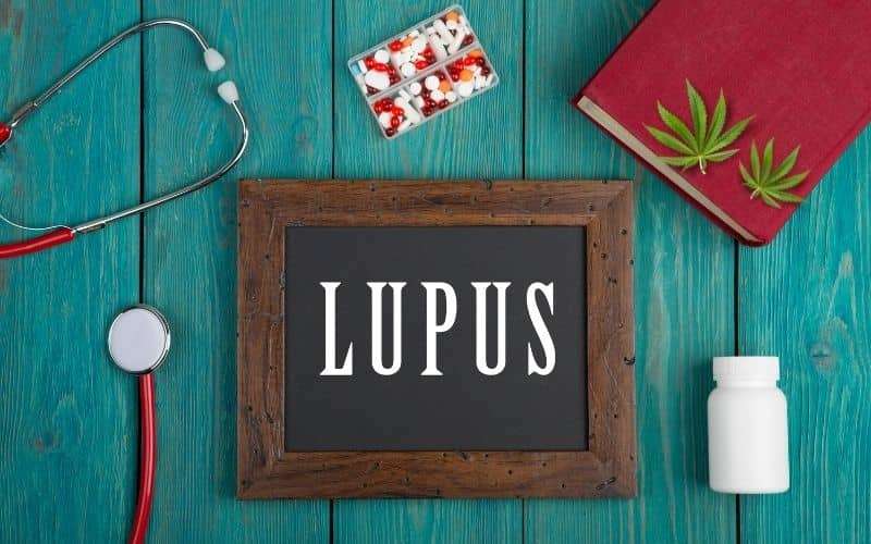 Medical Condition- Lupus : Types, Symptoms, Diagnosis and its treatment