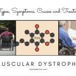 Medical Condition Muscular Dystrophy - Types, Symptoms, Causes and treatment