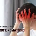 Medical Condition Neurofibromatosis symptoms, causes and treatment