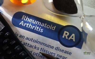 Rheumatoid Arthritis : Symptoms, Causes and Treatment