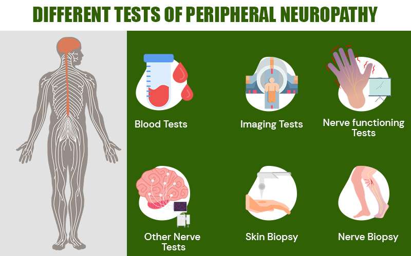 Different tests of Peripheral  neuropathy