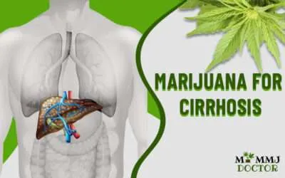The Role of Marijuana for Cirrhosis: Know The Potential Therapeutic Effects