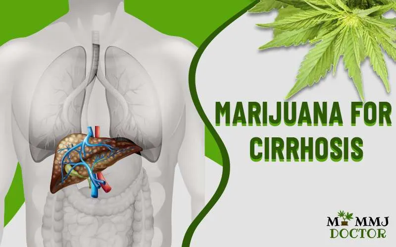 Marijuana for Cirrhosis